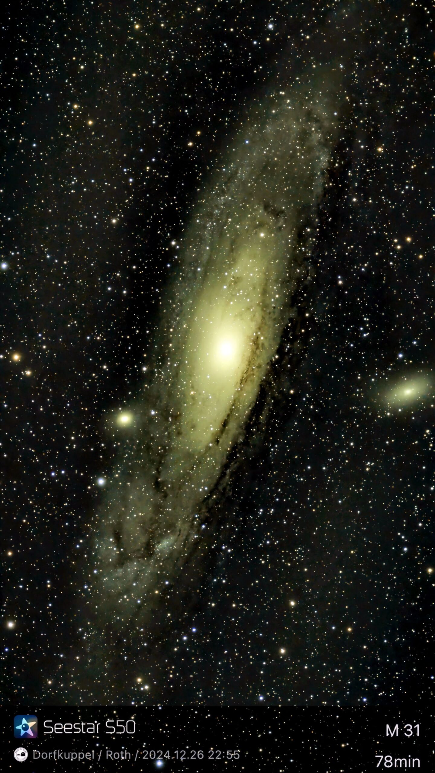 M 31 – Andromeda Galaxie (Seestar)